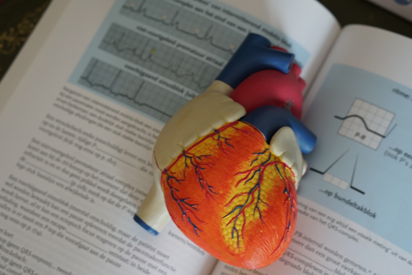 Stethoscope resting on an ECG trace